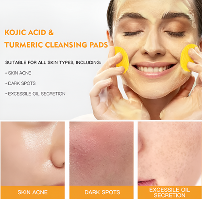 Turmeric & Kojic Acid Cleansing Pads (50 Pads)